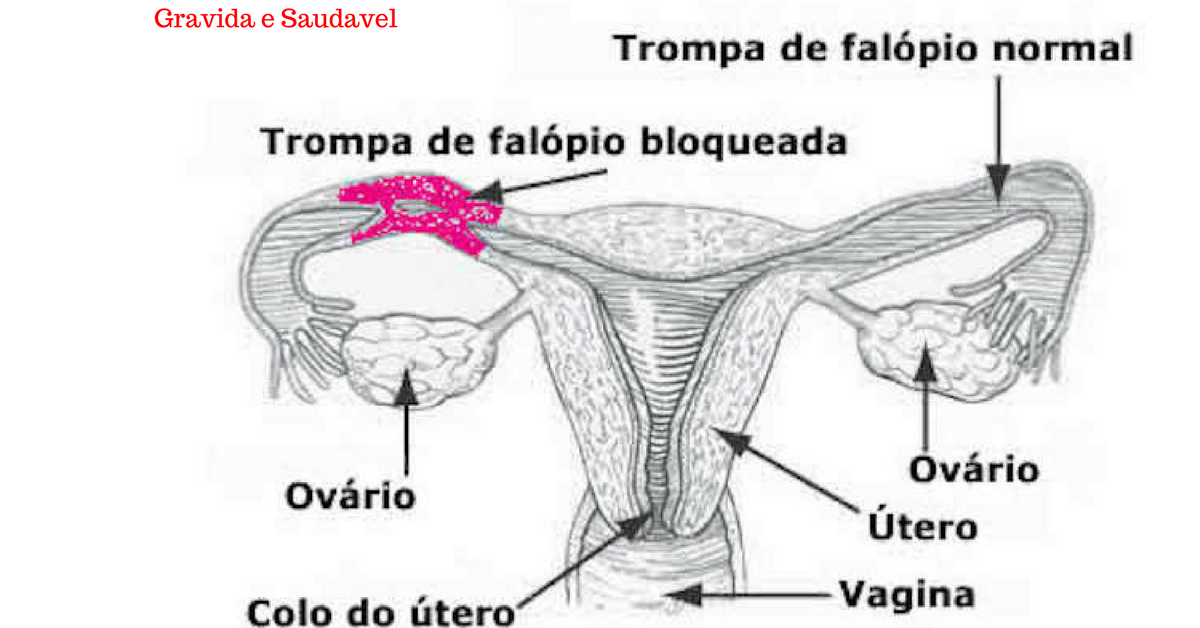 Image Title My Image